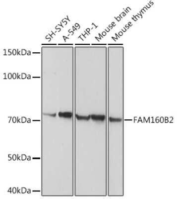 Western Blot: RAI16 Antibody [NBP2-94607] - Western blot analysis of extracts of various cell lines, using RAI16 antibody (NBP2-94607) at 1:1000 dilution. Secondary antibody: HRP Goat Anti-Rabbit IgG (H+L) at 1:10000 dilution. Lysates/proteins: 25ug per lane. Blocking buffer: 3% nonfat dry milk in TBST. Detection: ECL Basic Kit. Exposure time: 10s.
